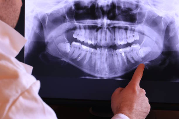 Best Tooth Pain Emergency Relief  in Coal Grove, OH